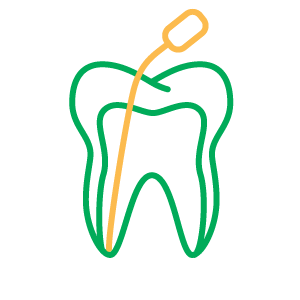 Issaquah Root Canals